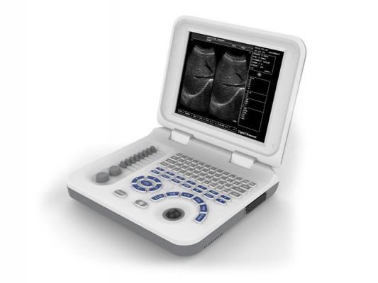 XF30數(shù)字B型超聲診斷儀（筆記本式）