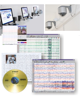 數字化視頻腦電監(jiān)護分析系統(tǒng)