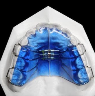 華偉定制式矯治器擴弓型、矯治保持型、牙膠片型