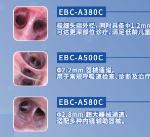 優(yōu)億一次性電子支氣管鏡ebc-a380c